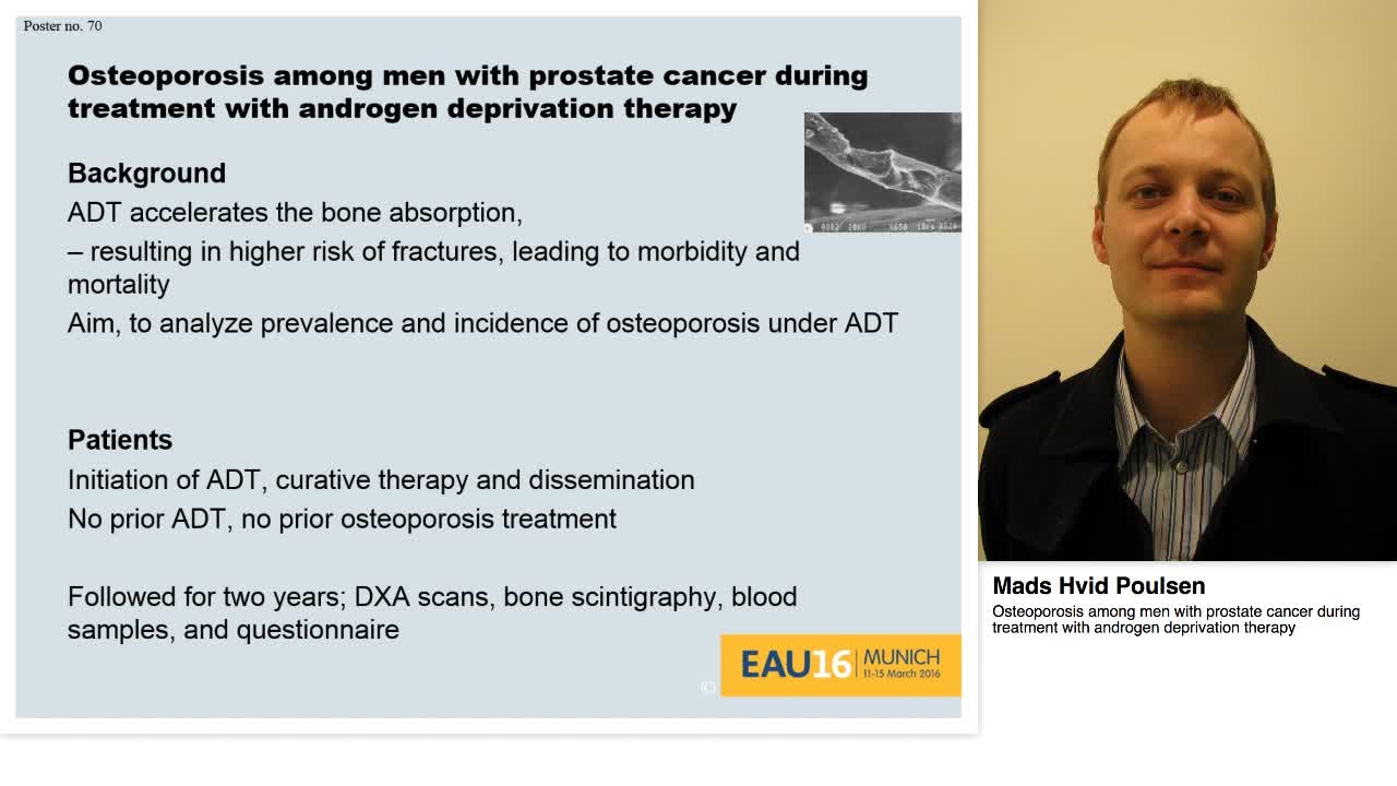 Osteoporosis among men with prostate cancer during treatm-