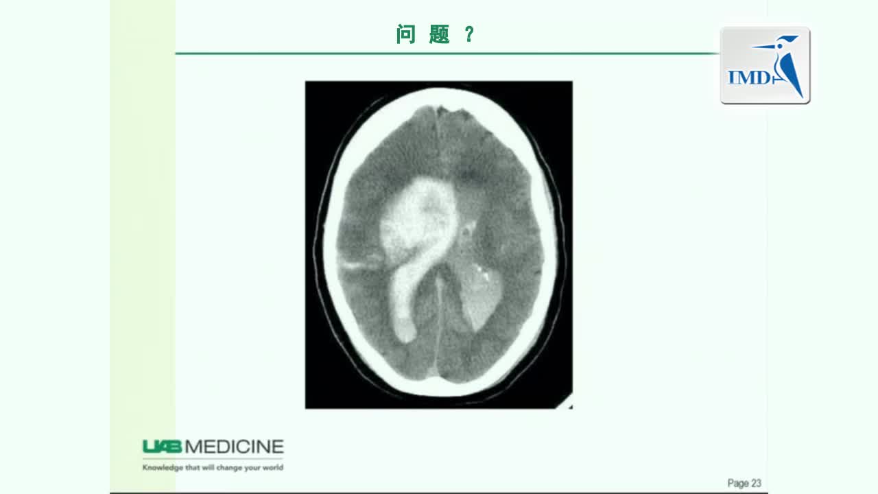 不同年龄组急性卒中治疗存在差距（2）