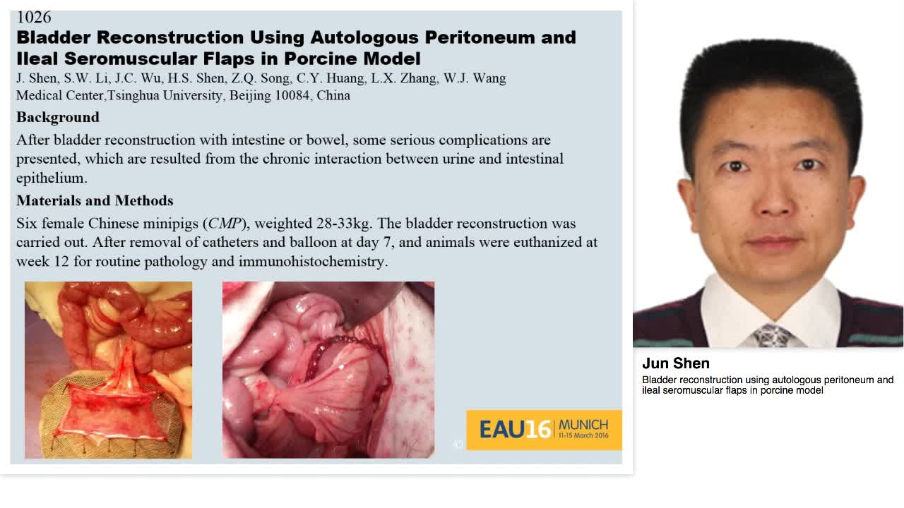 Bladder reconstruction using autologous peritoneum and il-