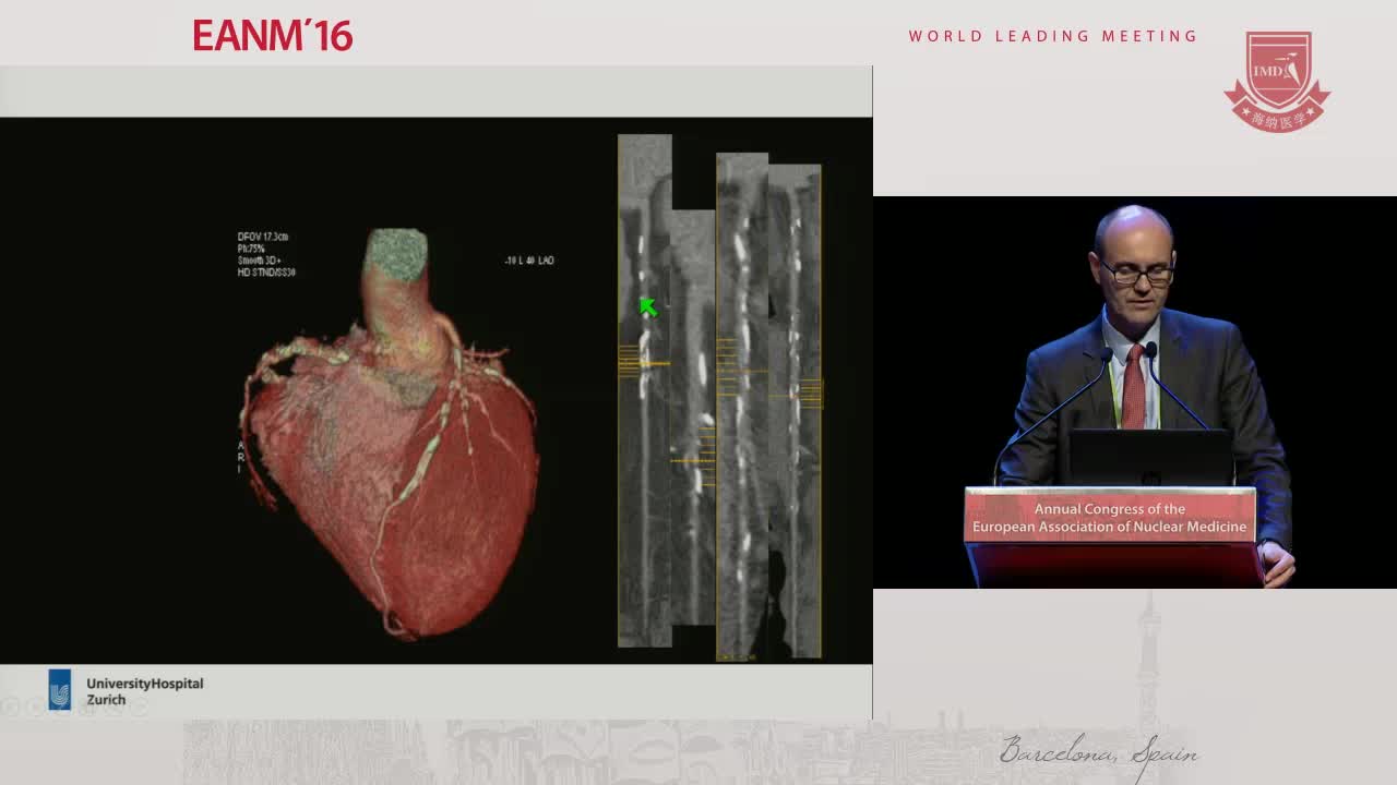 心脏病的指导治疗&mdash;&mdash;混合成像的作用3
