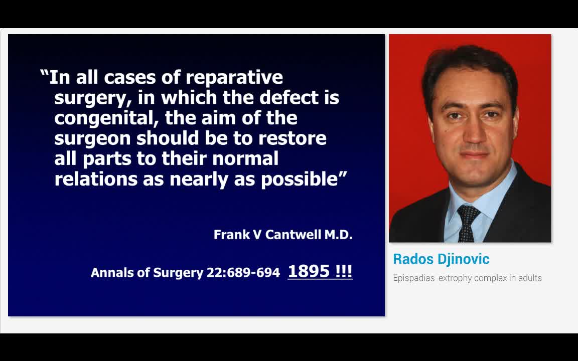 成人尿道上裂外翻综合体