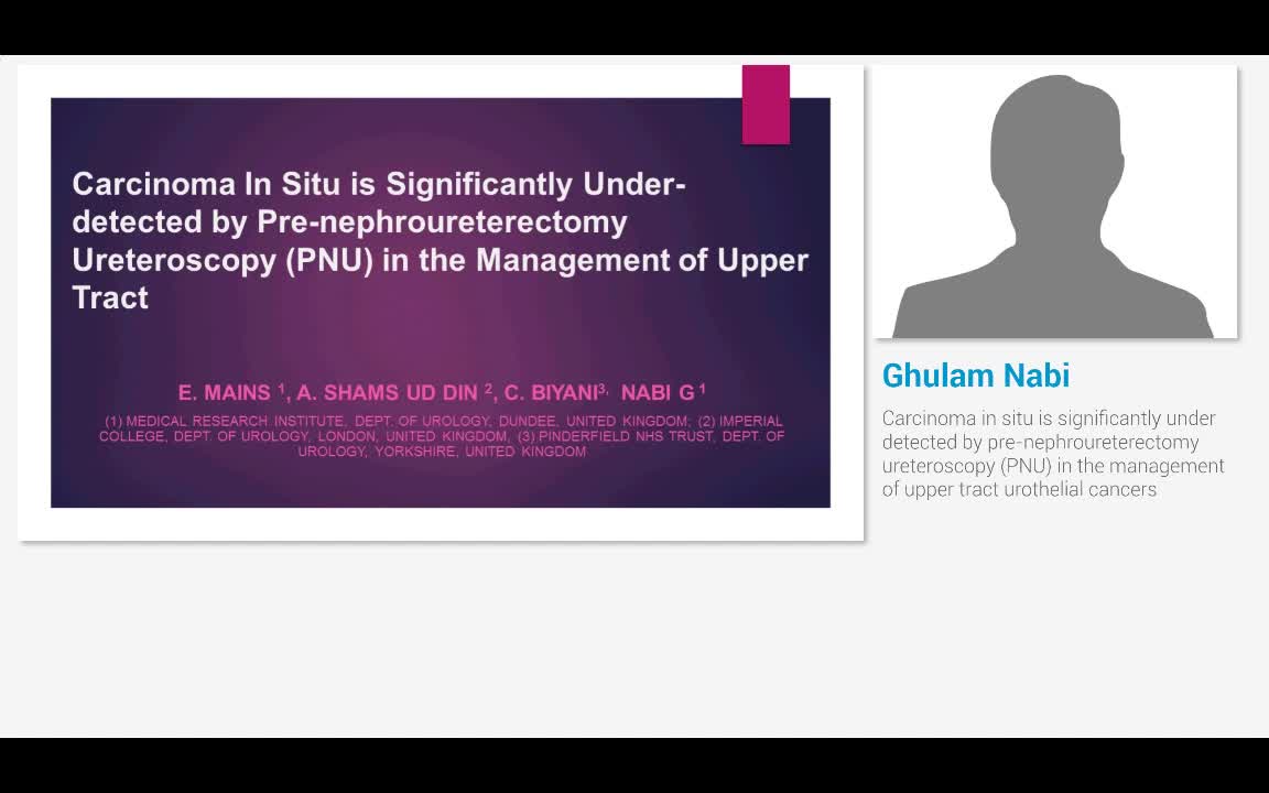 Carcinoma in situ is significantly under detected by pre-..-