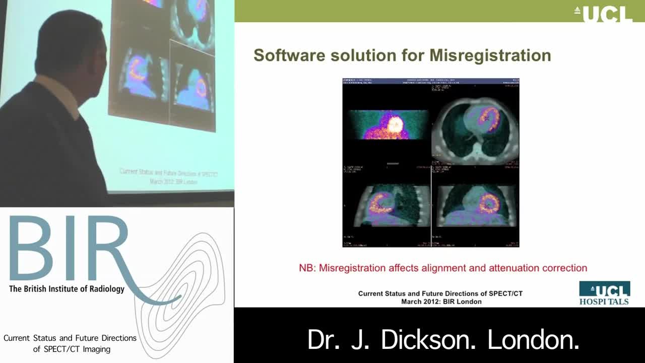 为何使用SPECT和CT技术（6）