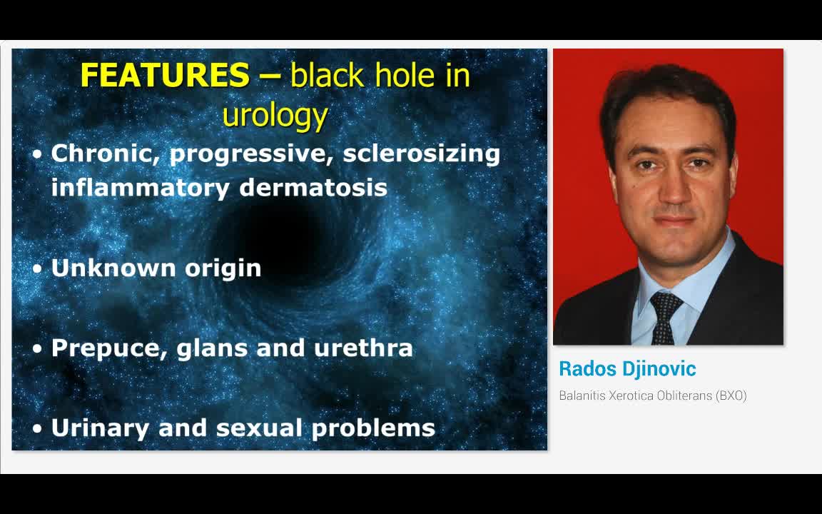 Balanitis Xerotica Obliterans (BXO)