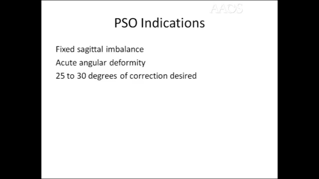Pedicle Subtraction Osteotomy (PSO) lnstructional Video