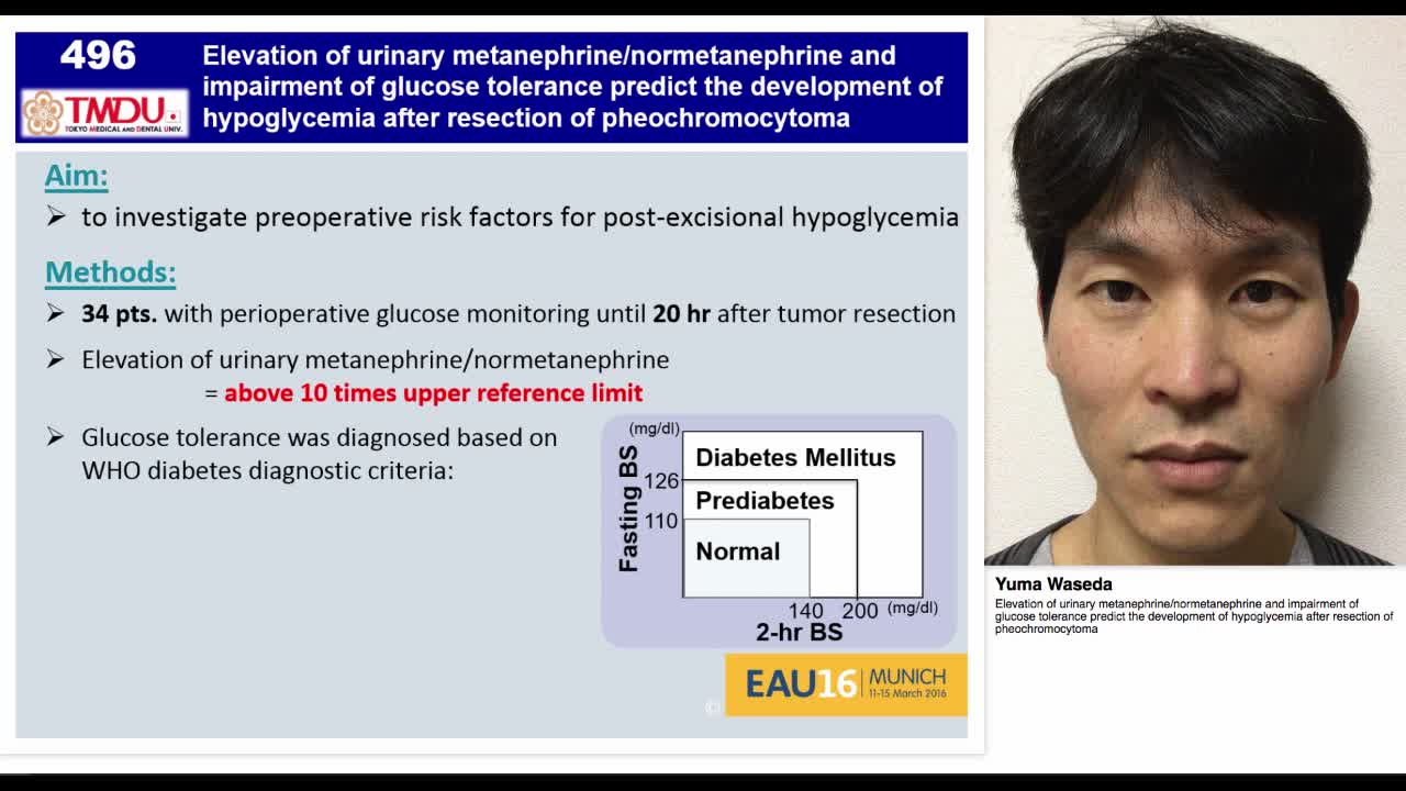 Elevation of urinary metanephrine-normetanephrine and imp-