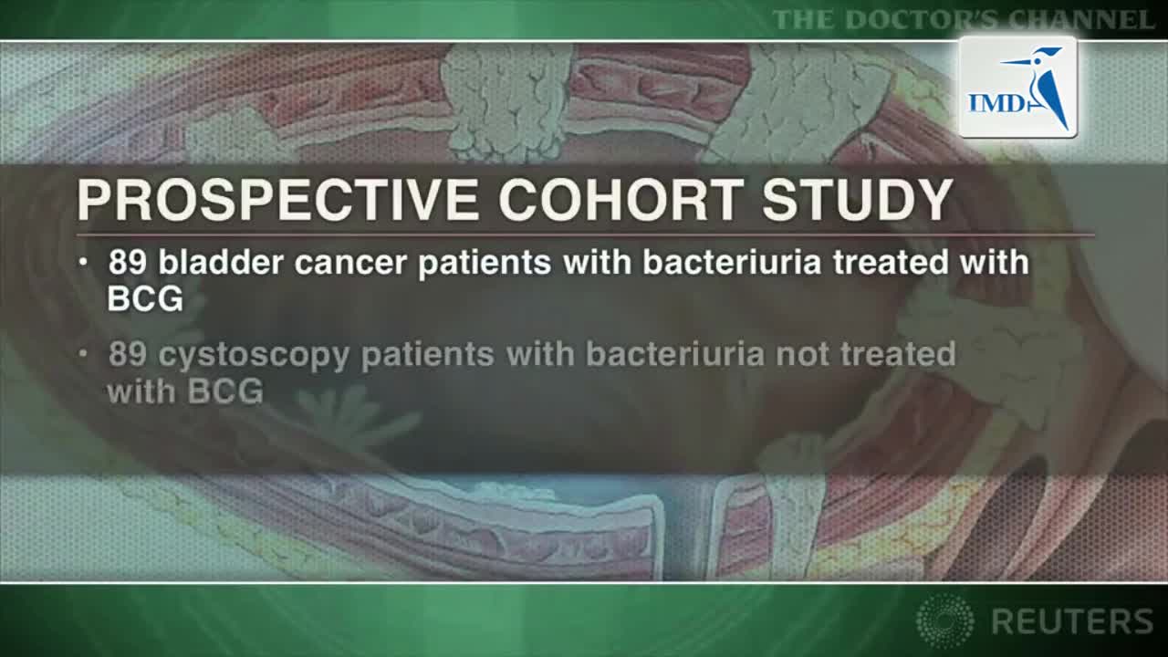 膀胱灌注BCG可有助于膀胱癌患者消除菌尿