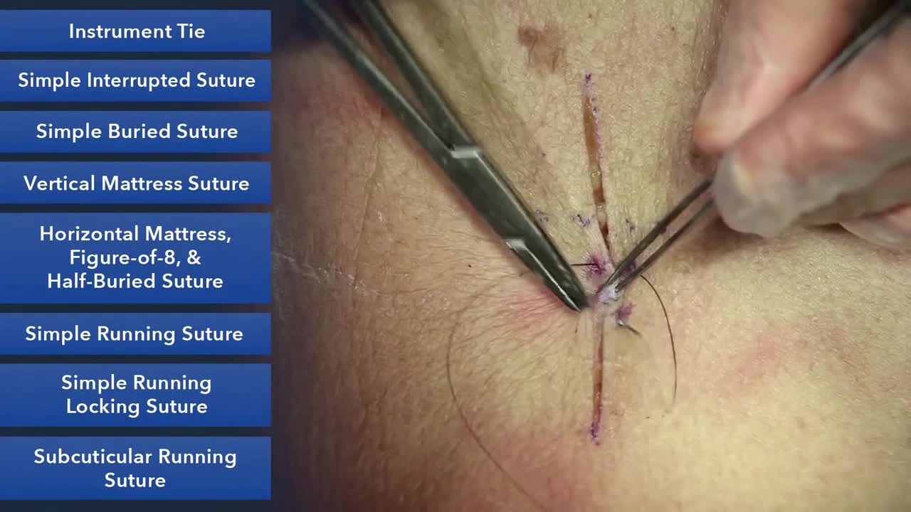 杜克缝合手术技能课程（3）