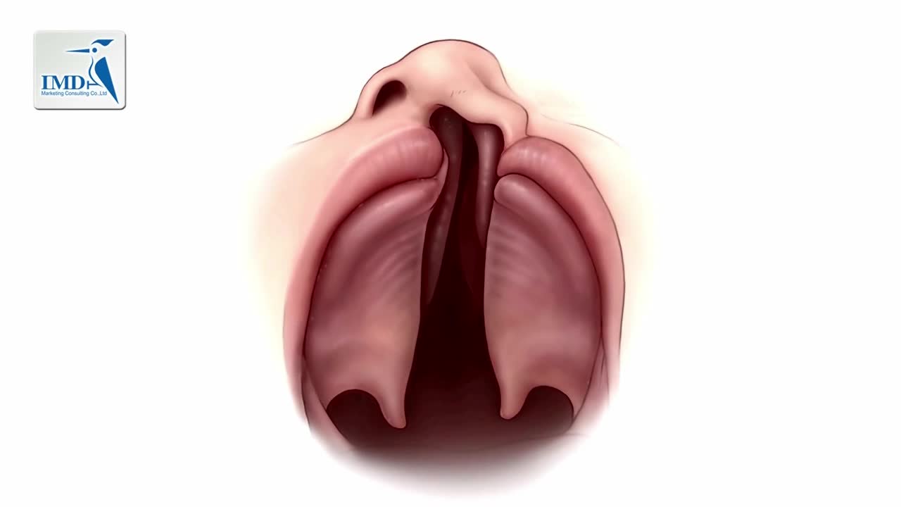 儿童唇腭裂治疗（1）