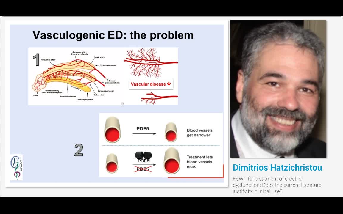 ESWT for treatment of erectile dysfunction, Does the curr..-