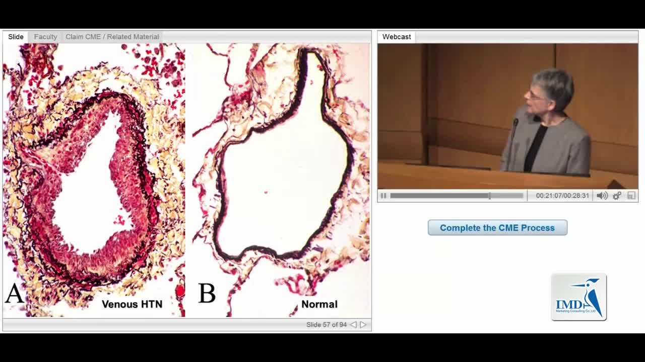 肺动脉高压的病理关系（4）