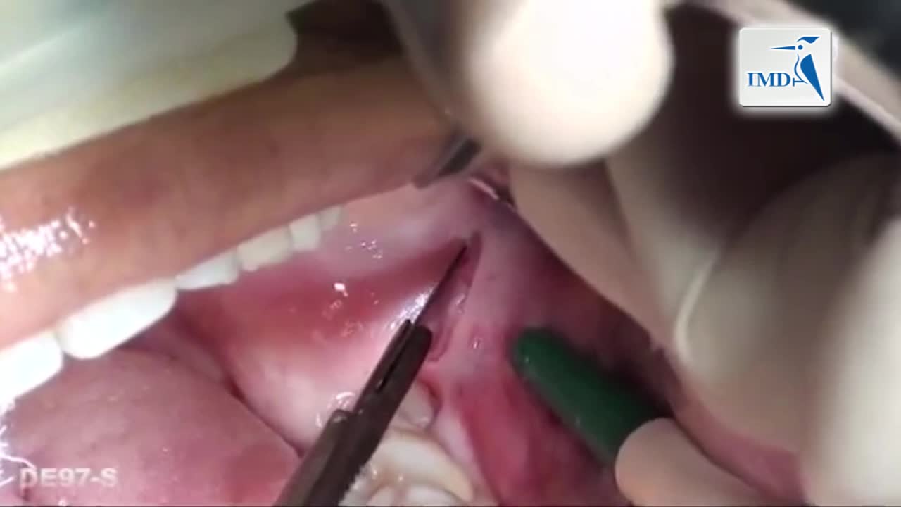 齿外科手术基础篇--牙科手术中的基本技能（2）