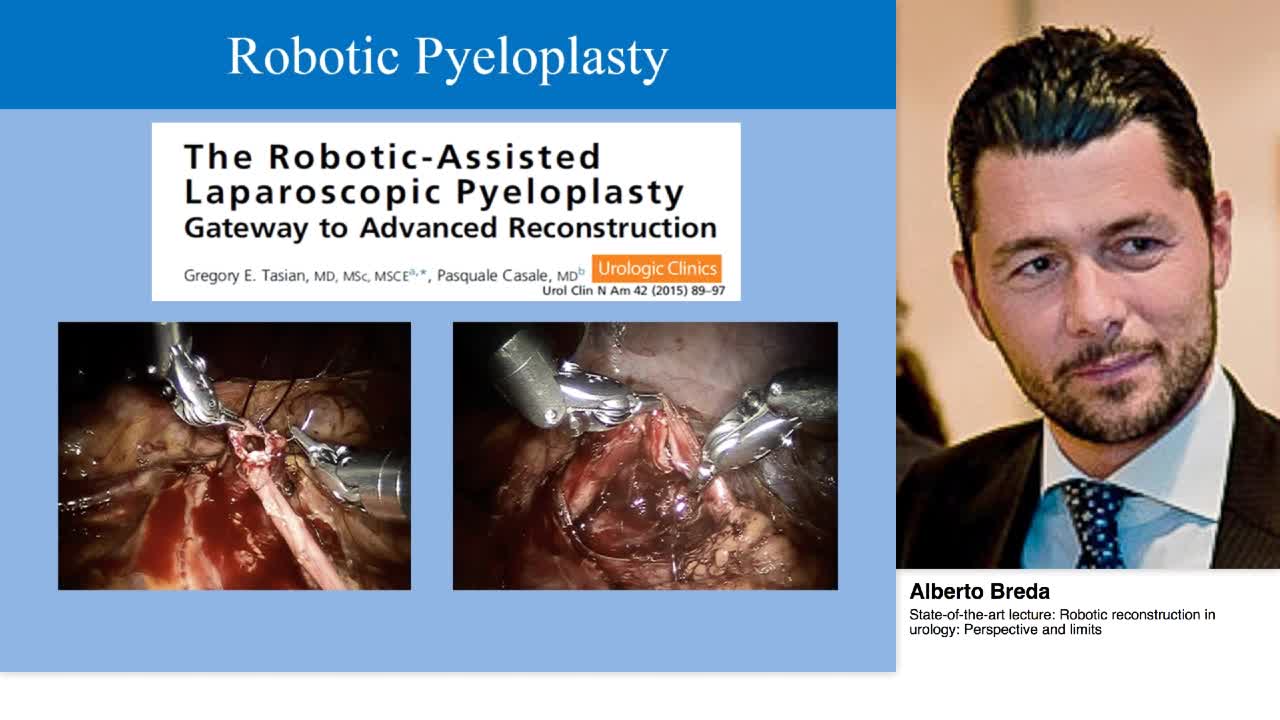 Robotic reconstruction in urology, Perspective and limits