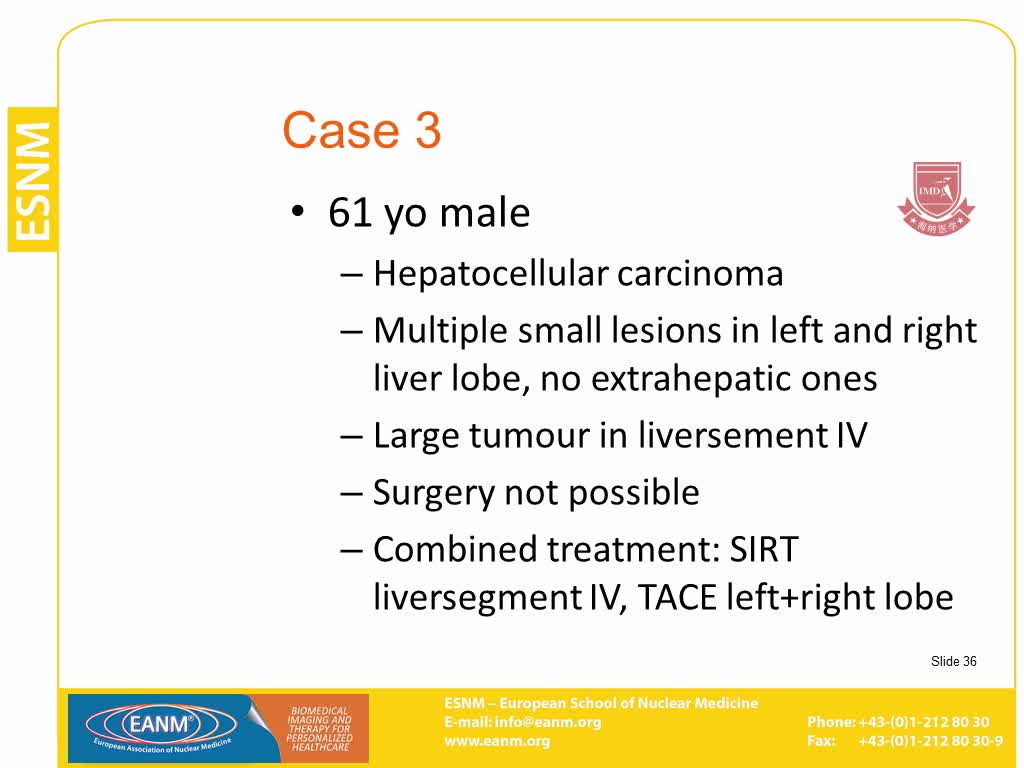 PET CT用于计划和监测放射性核素治疗方案6