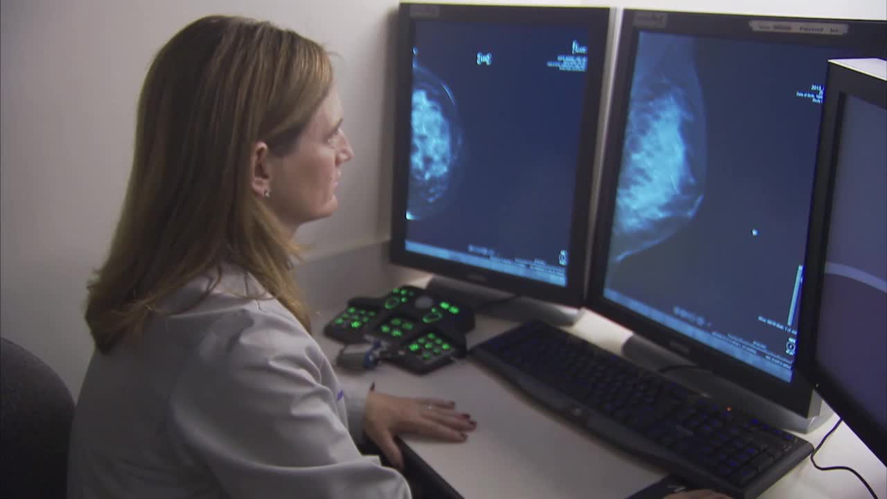 Estrogen Blocking Drugs Can Decrease Risk of Breast Cancer