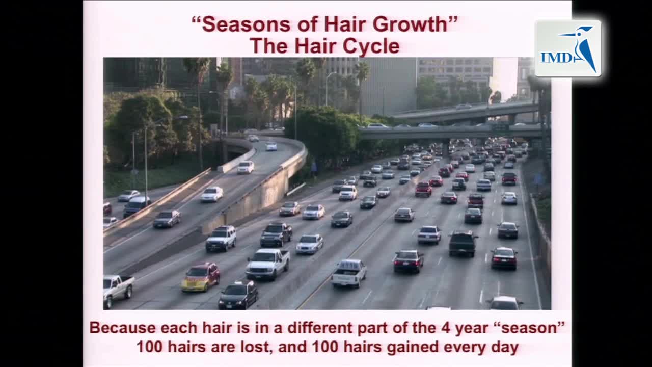 脱发的新兴治疗方法（3）