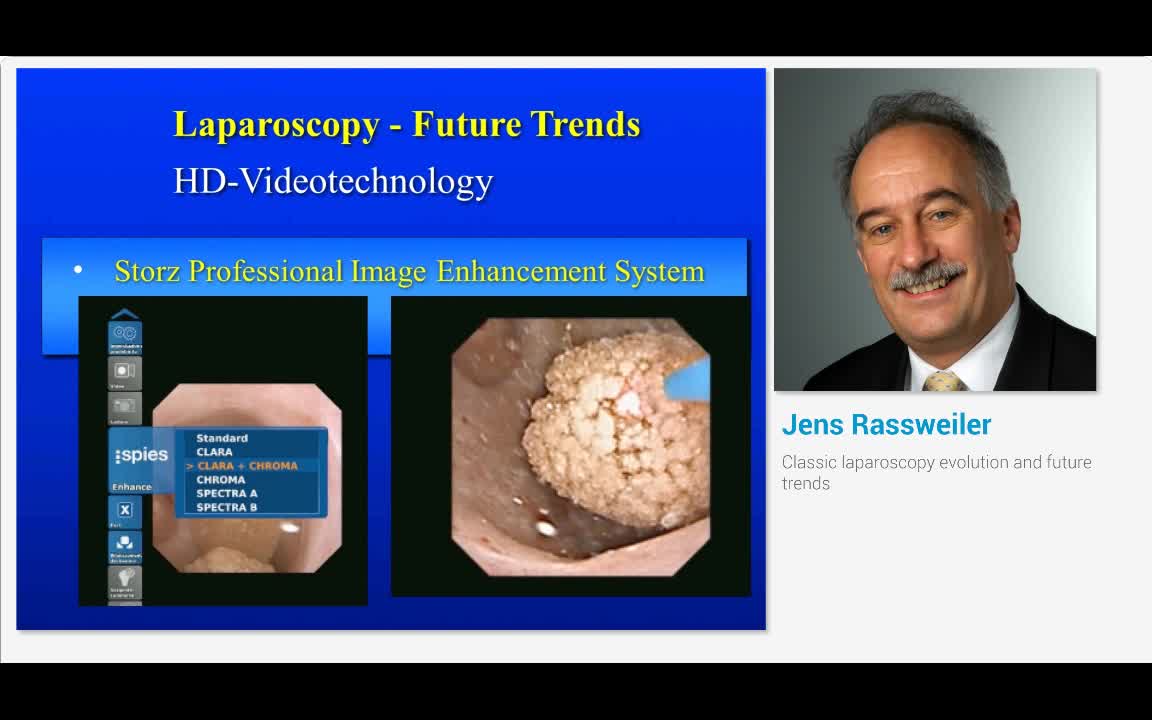 Classic laparoscopy evolution and future trends