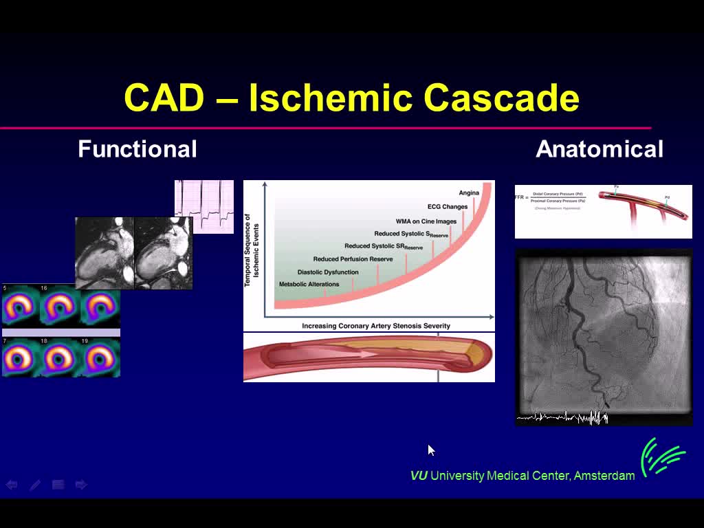 心脏门控在PET和SPECT中的临床应用