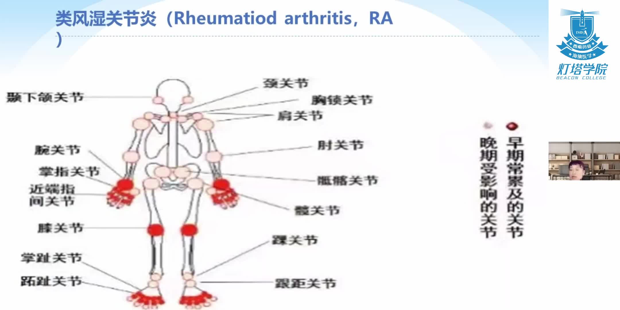 常见关节疾病介绍