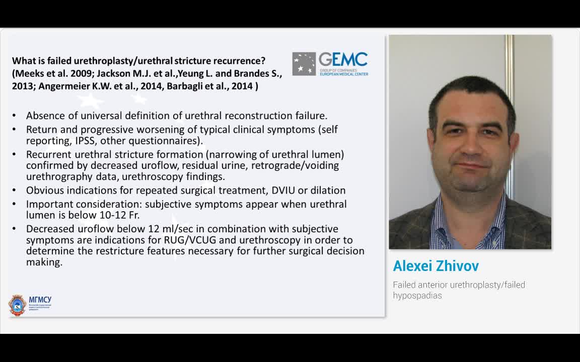 失败的前尿道成形术&mdash;&mdash;失败的尿道下裂