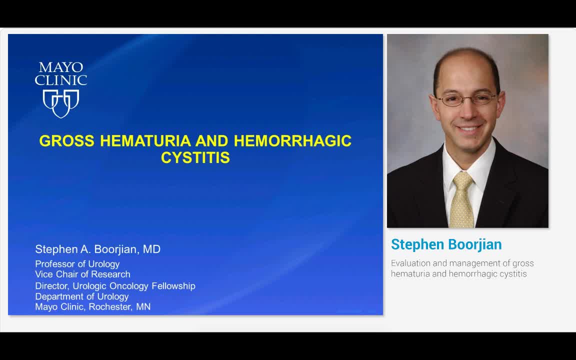 Evaluation and management of gross hematuria and hemorrha..-
