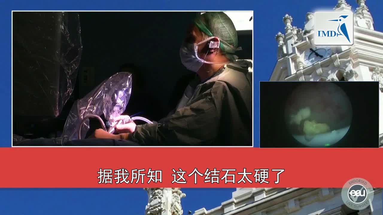 微创经皮肾镜取石术中的新理念（4）