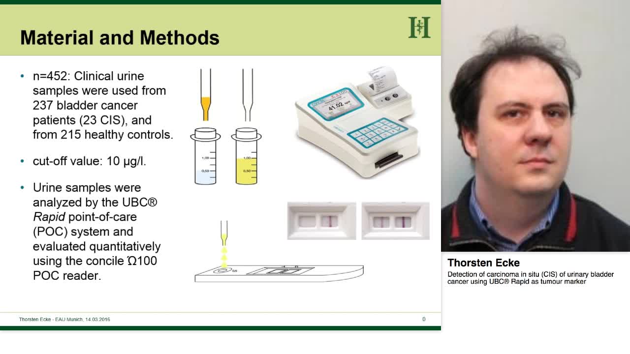 Detection of carcinoma in situ (CIS) of urinary bladder c-