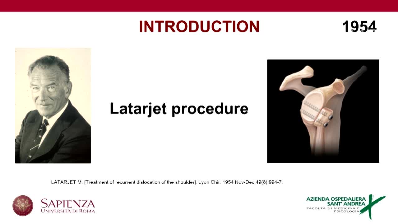Modified boneless L atarjet procedure for recurrent anterior shoulder dislocation