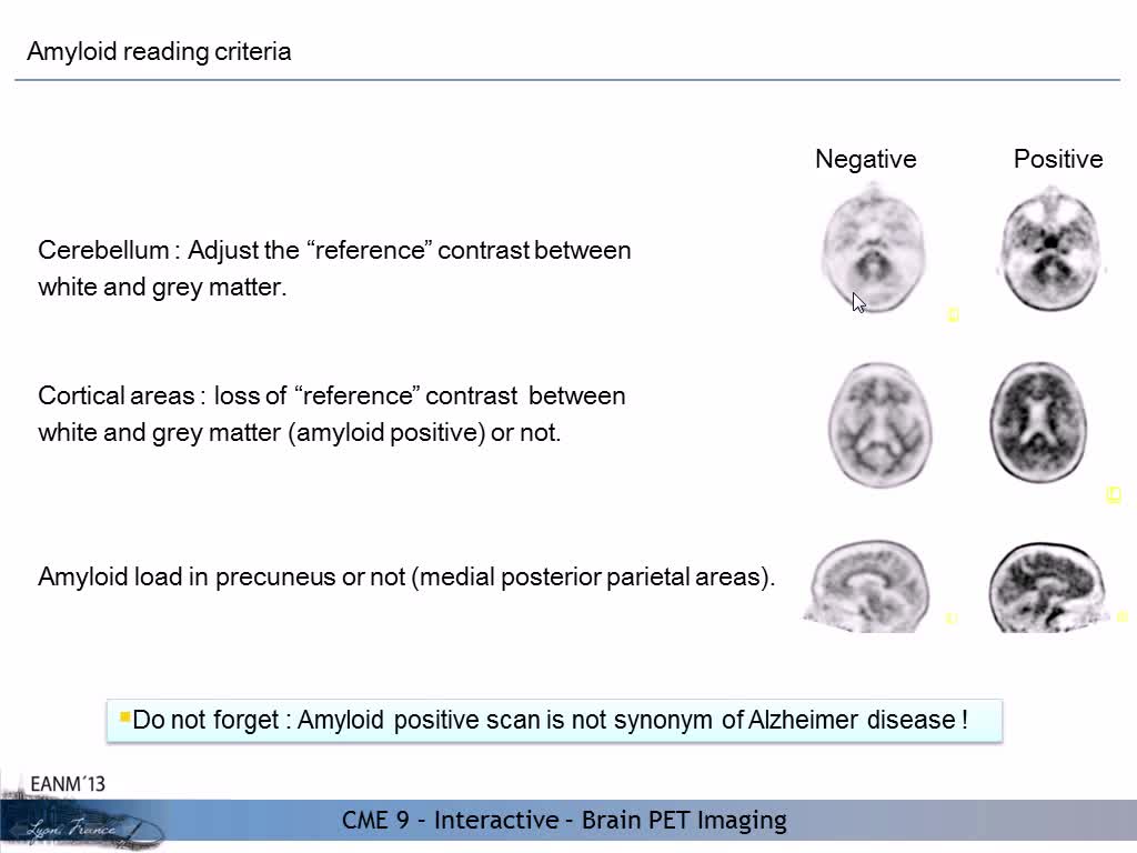 如何读取淀粉样蛋白图像