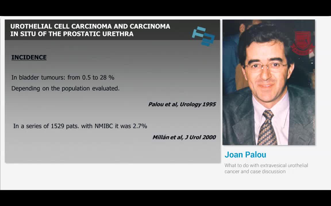 如何处理膀胱外尿路上皮癌和病例