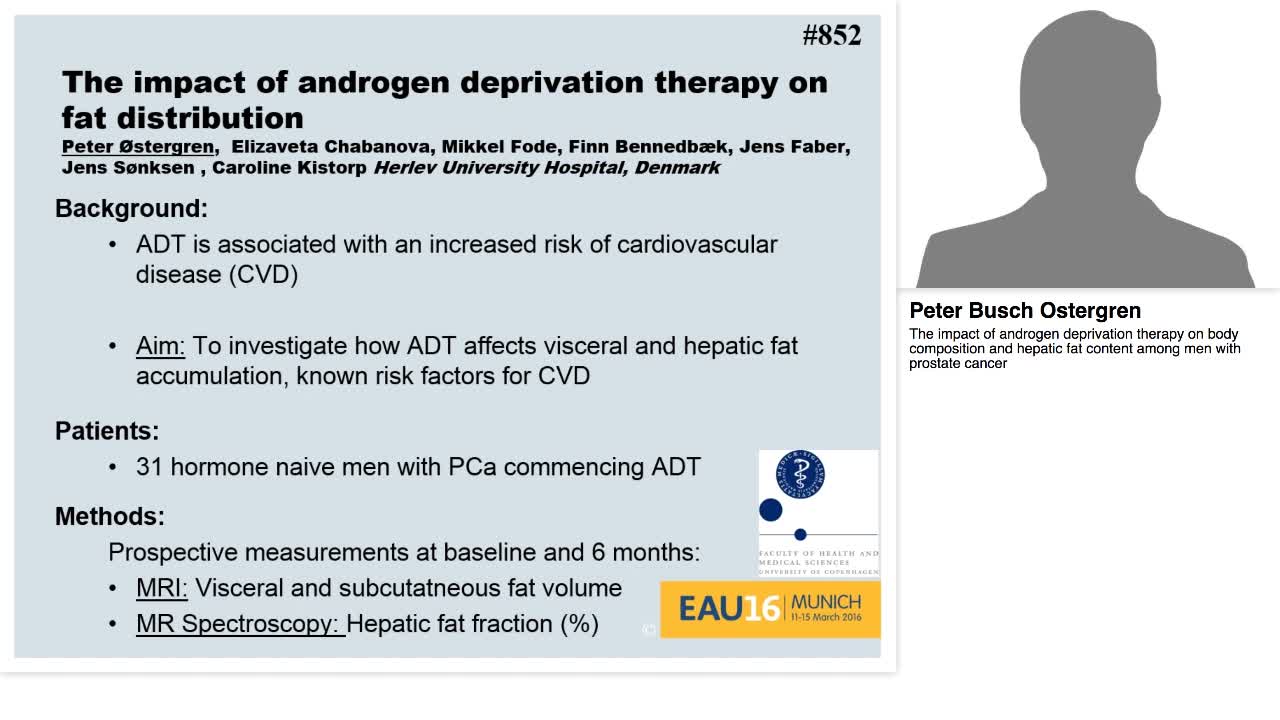 The impact of androgen deprivation therapy on body compos-