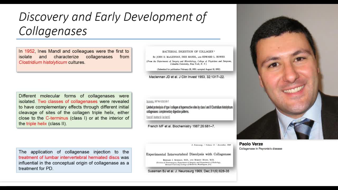 Collagenase in Peyronie's disease