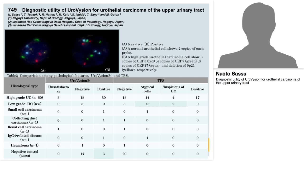 Diagnostic utility of UroVysion for urothelial carcinoma -