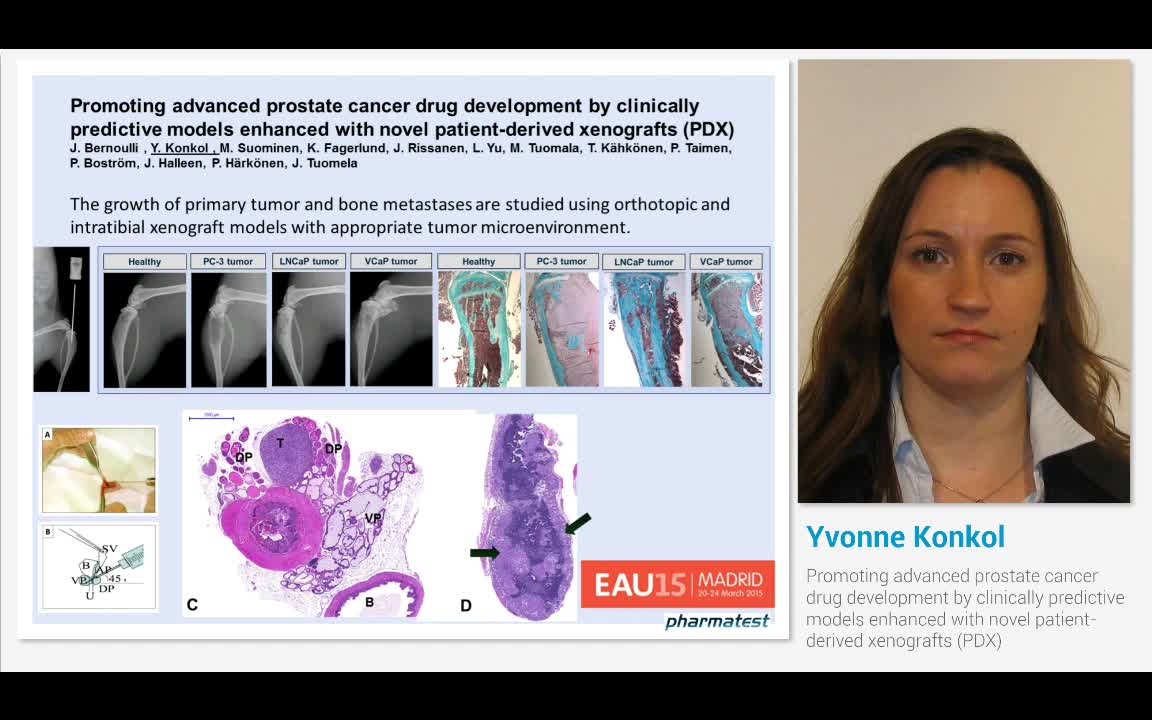 Promoting advanced prostate cancer drug development by cl..-