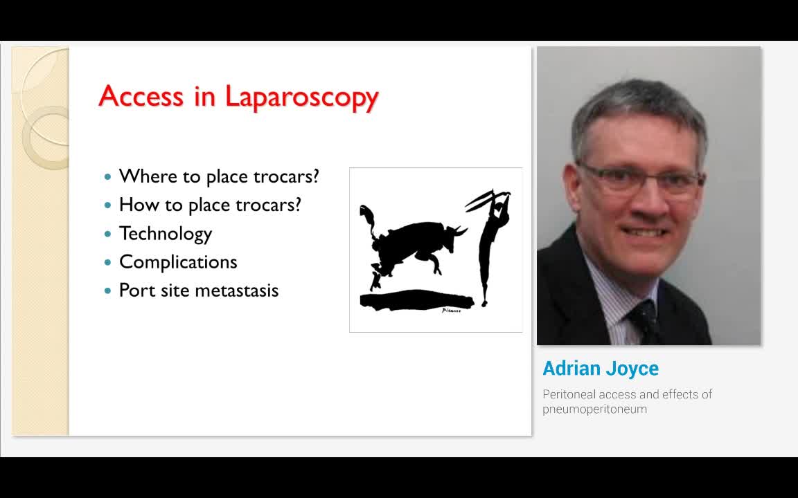 Peritoneal access and effects of pneumoperitoneum