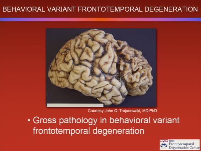 Neural Network Supporting Executive Functioning in Frontotemporal Degeneration