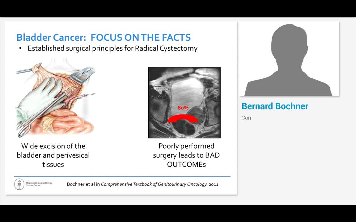 Is robotic cystectomy the future standard - Con