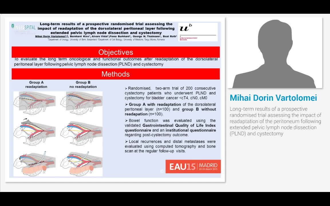 Long-term results of a prospective randomised trial asses..-