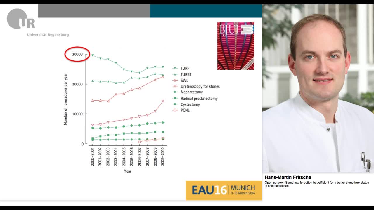 Open surgery, Somehow forgotten but efficient for a bette-