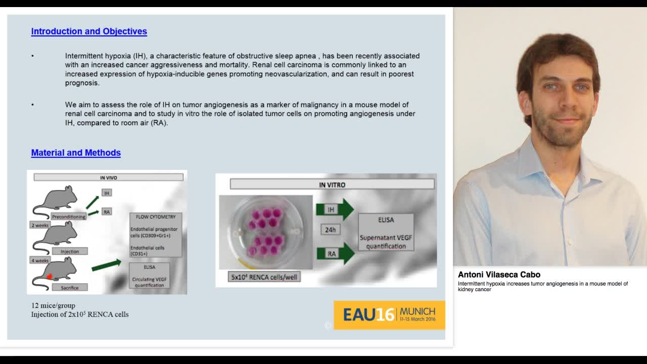 Intermittent hypoxia increases tumor angiogenesis in a mo-