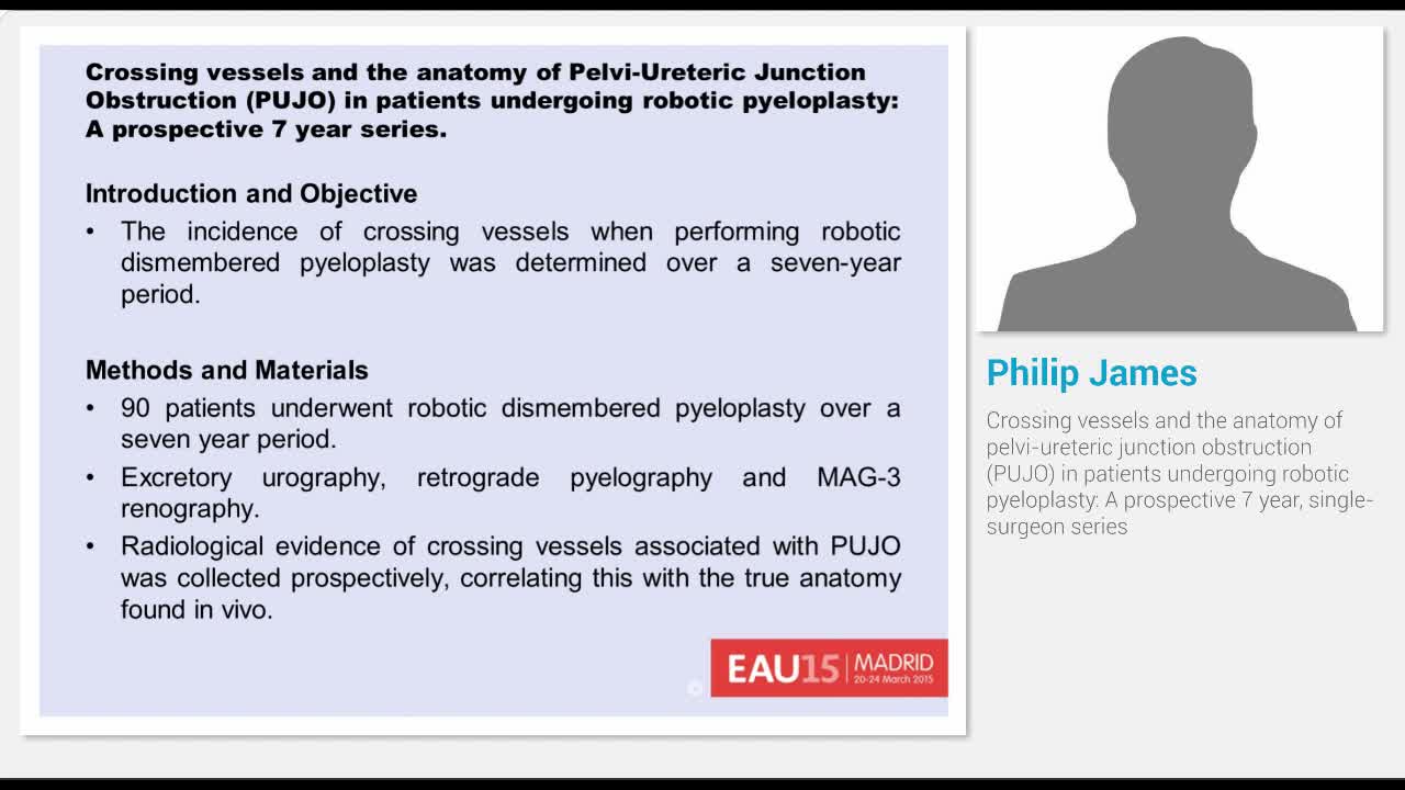 Crossing vessels and the anatomy of pelvi-ureteric juncti..-