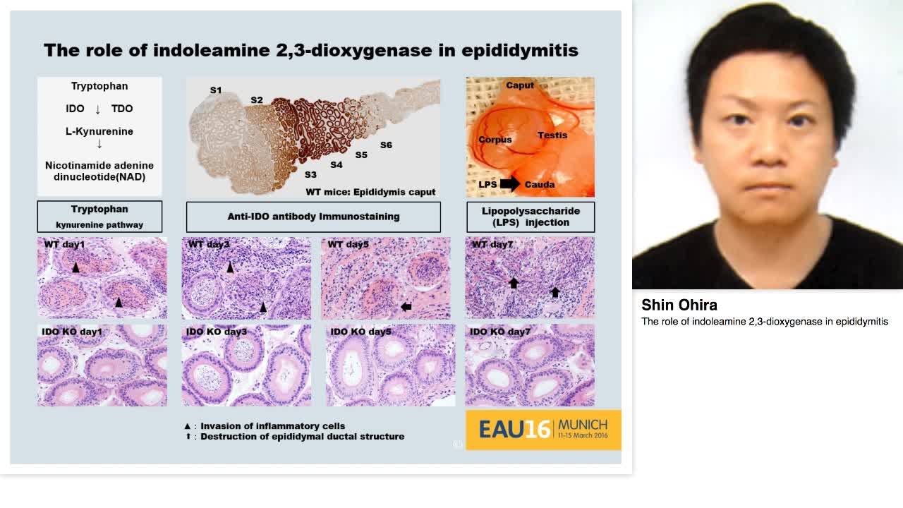The role of indoleamine 2,3-dioxygenase in epididymitis