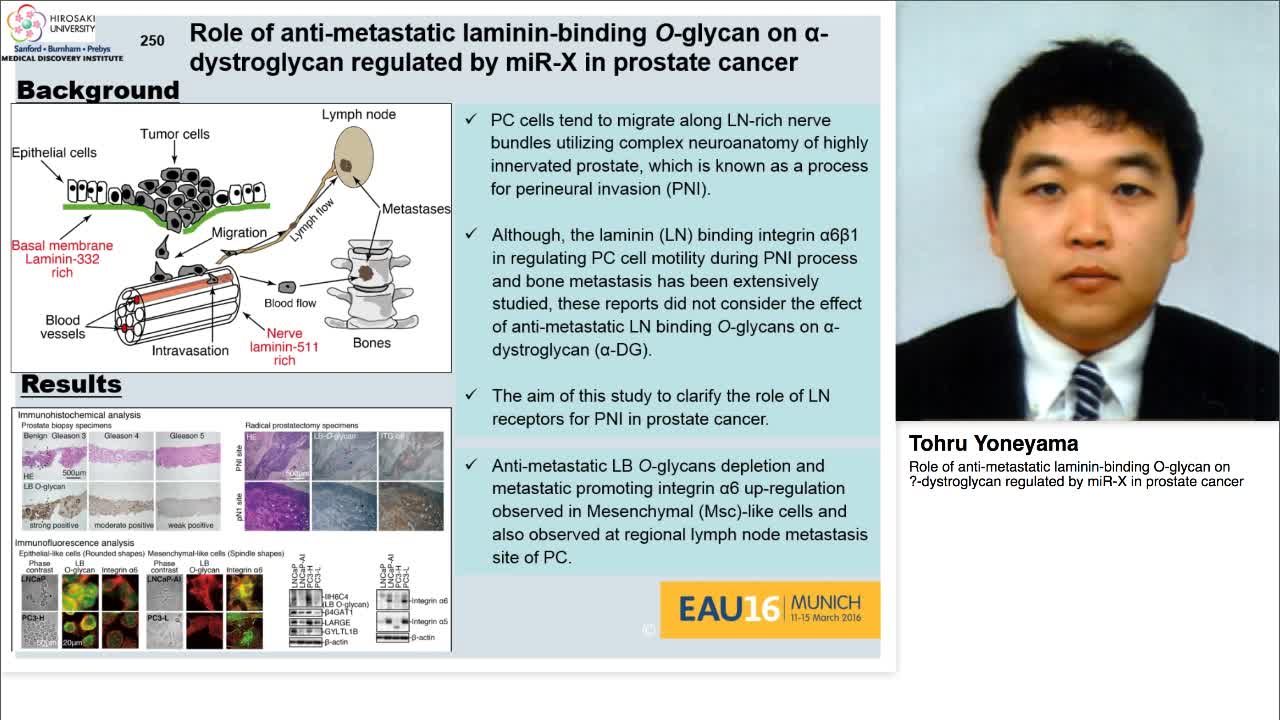 Role of anti-metastatic laminin-binding O-glycan on .-dys-