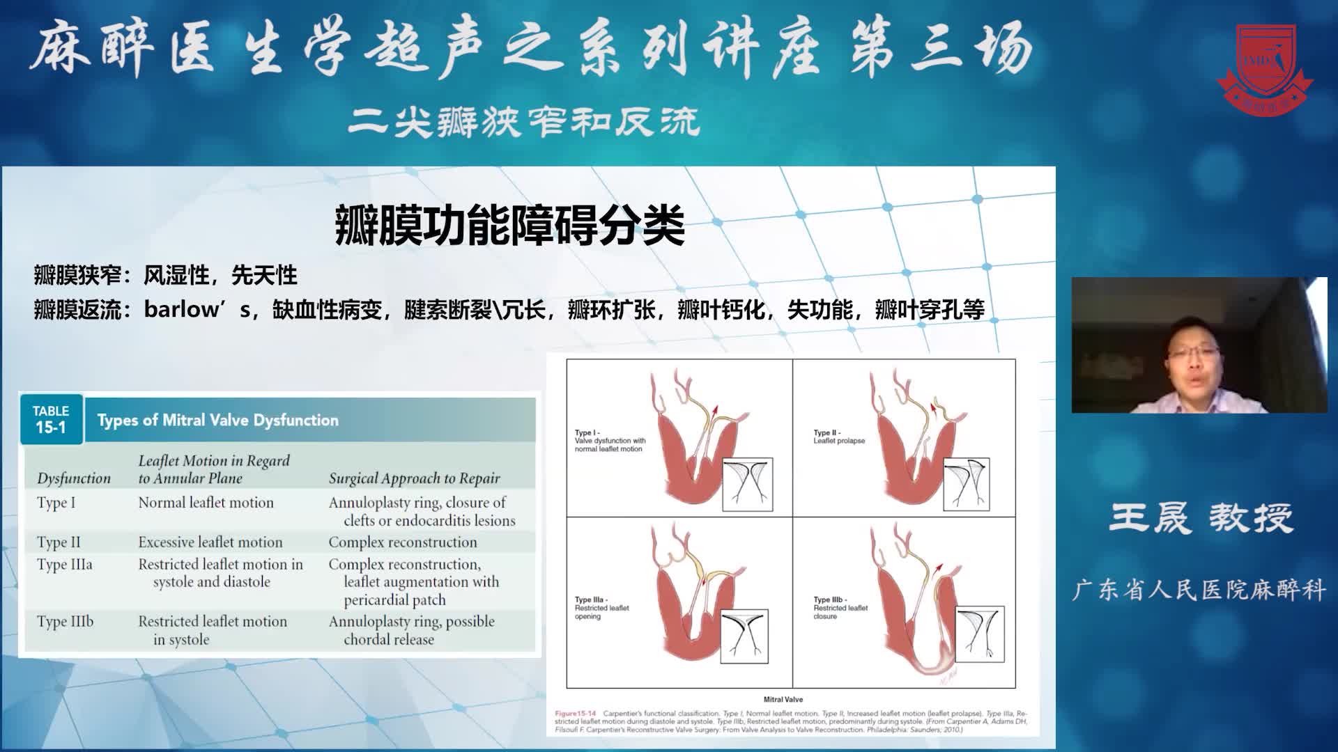二尖瓣狭窄和反流  王晟 教授 02
