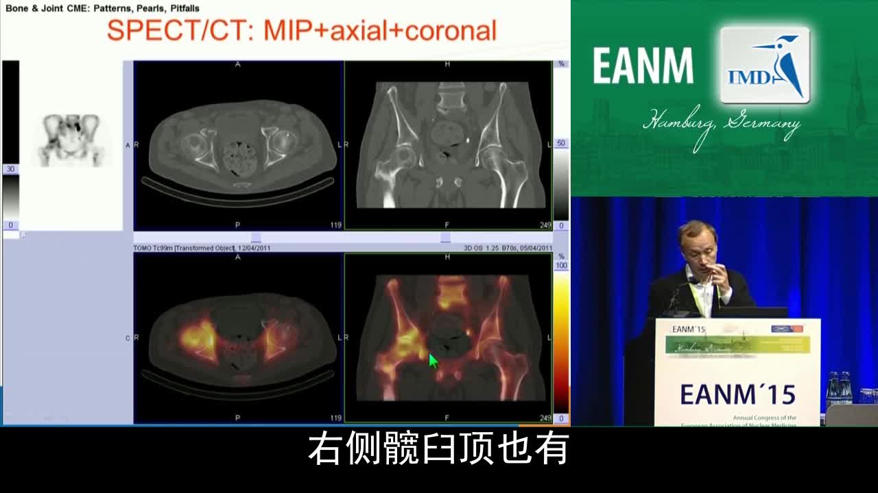 骨骼与关节继续医学教育-精华（4）