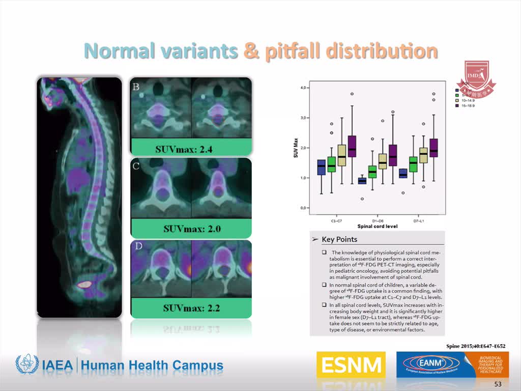 儿科：PET CT的缺陷3