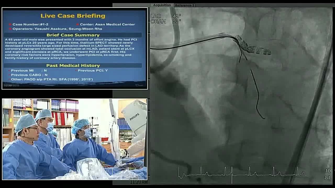 血管内手术现场案例一（4）