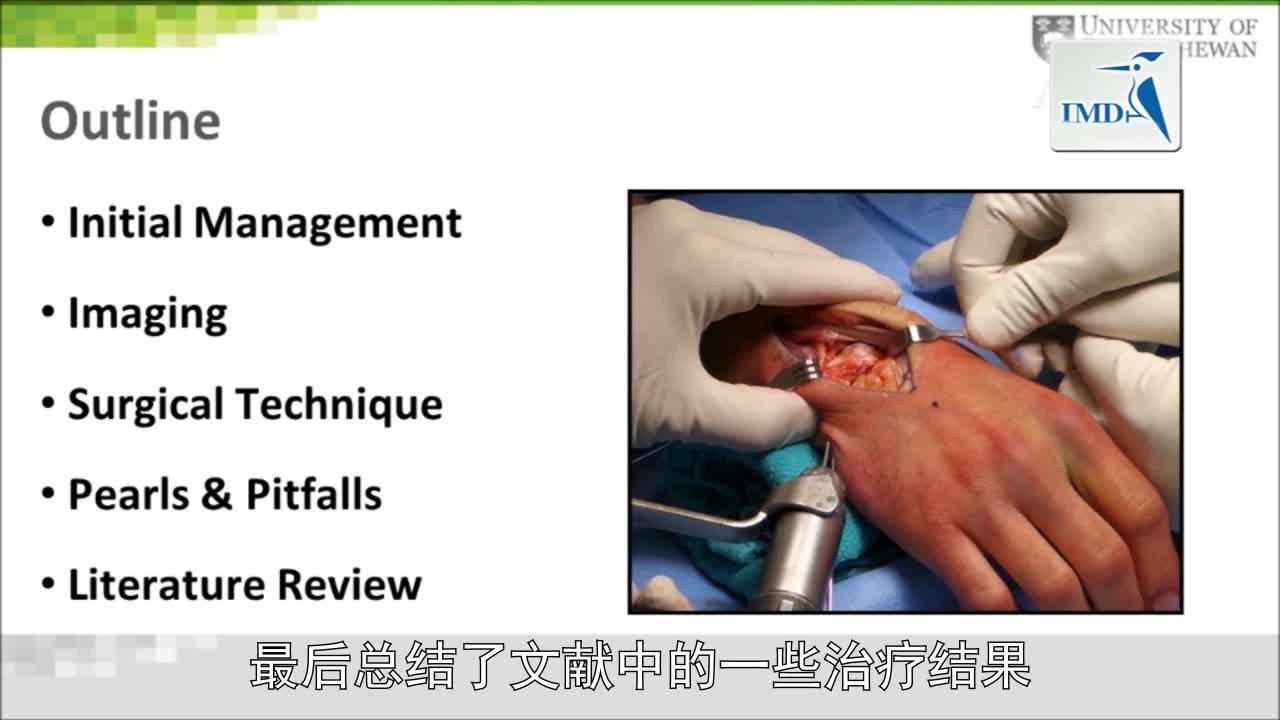经舟骨月骨周围骨折脱位：手术技巧（1）