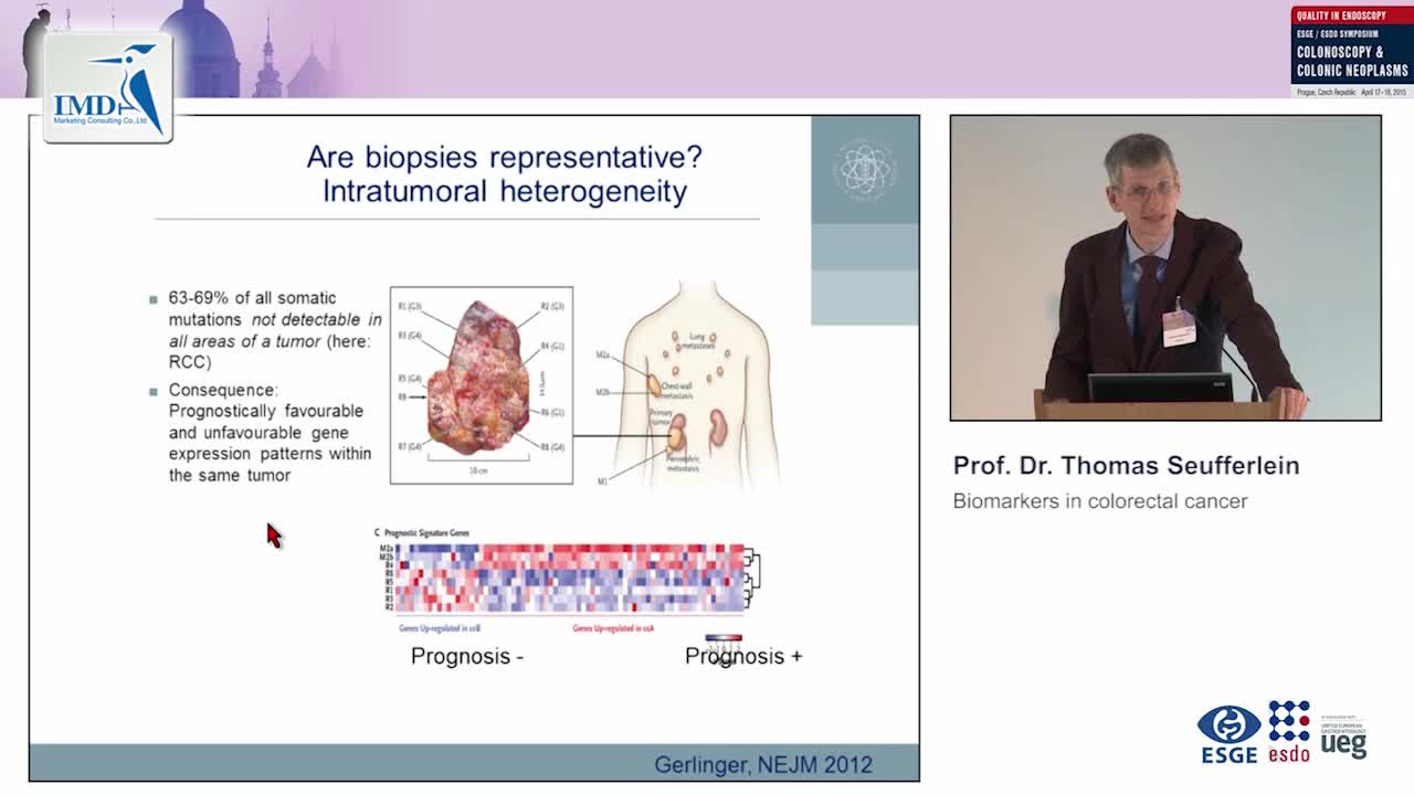 结直肠癌的生物标志物（3）