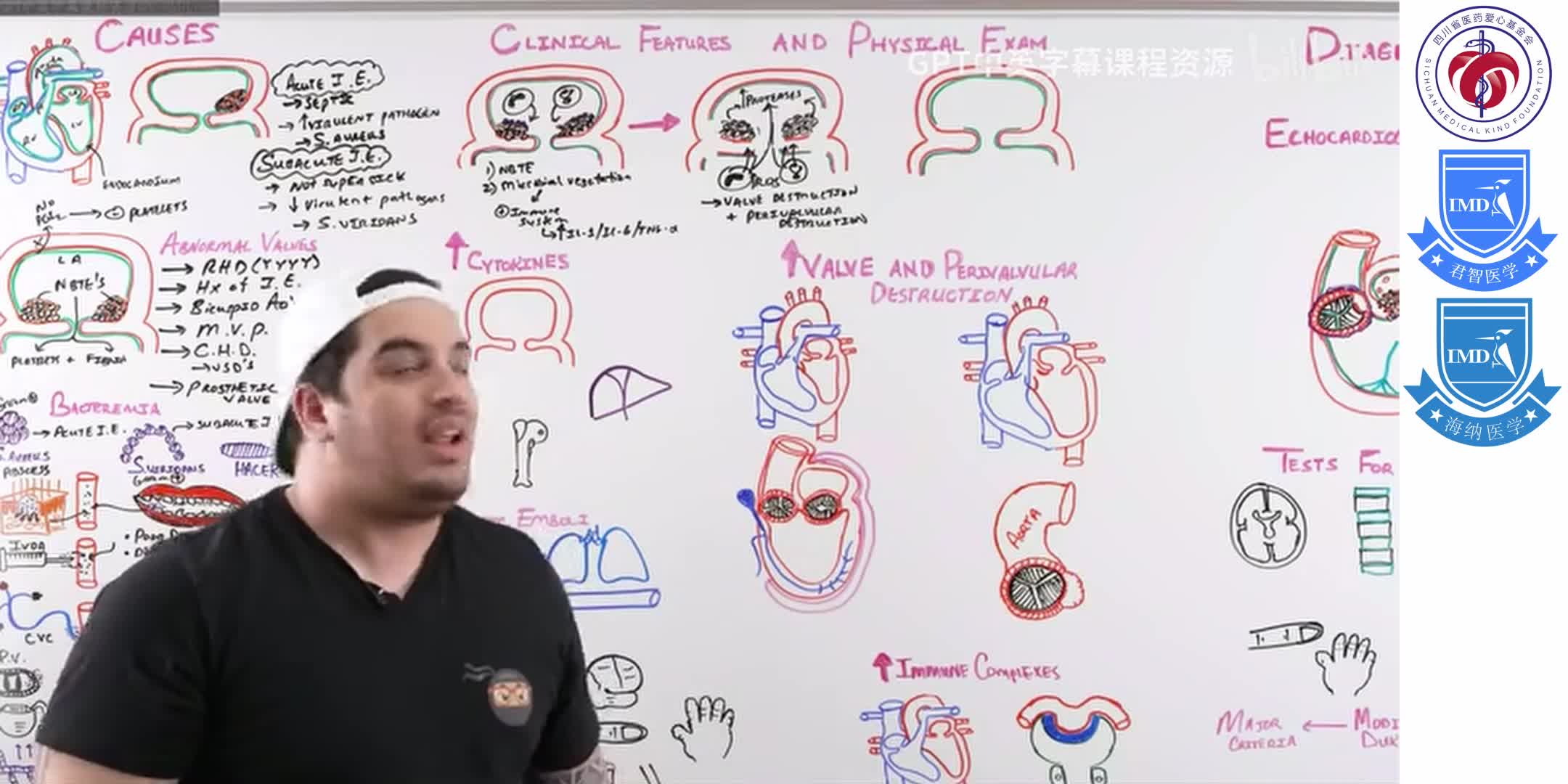 Infective Endocarditis 4